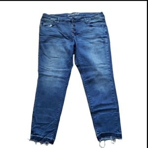 Button Fly Ankle Skinny Jeans
